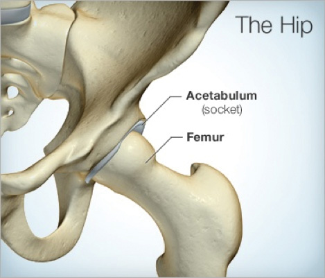 hip-arthoscopy